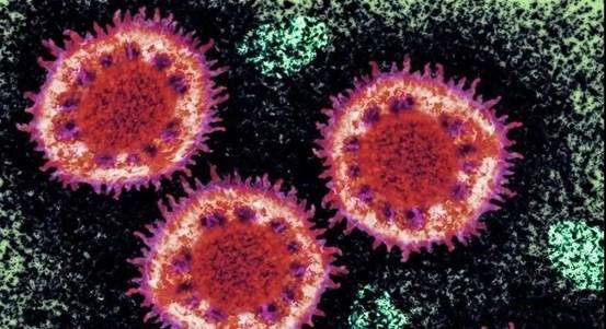 微信图片_20200326154536